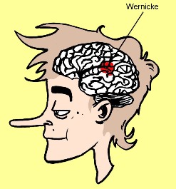 Gebied van Wernicke in de hersenen